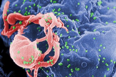 HIV attacking cell