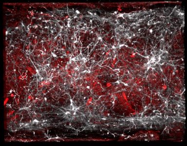 Vasculature cells and dopamine-producing neurones